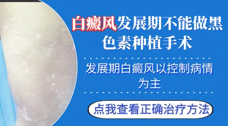 进展期白斑能做表皮移植手术吗