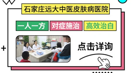白癜风用JAK抑制剂治疗效果怎么样