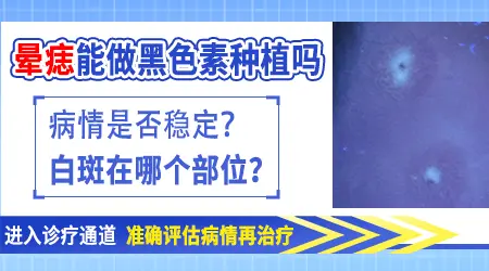 晕痣白癜风可以用植皮手术治疗吗