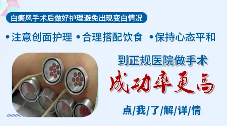 晕痣白癜风可以用植皮手术治疗吗