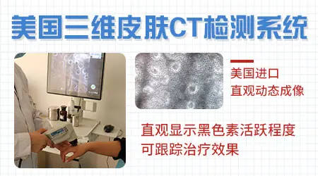 白癜风种植手术后还是发白是失败了吗