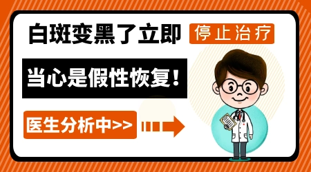 白癜风治疗期间白斑变黑是好转了吗