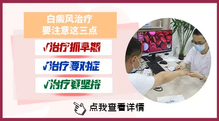 大面积白癜风怎么治疗效果好