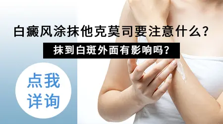 黑色素缺失涂他克莫司软膏有用吗