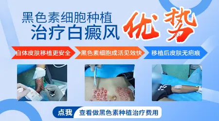 白癜风植皮和黑素细胞移植选哪个更靠谱