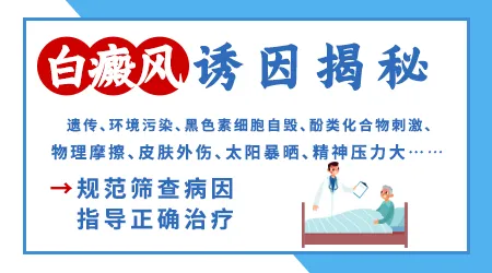 家族没有病史为什么会得白癜风
