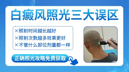 白癜风长期照308光会不会增加皮肤癌变的风险