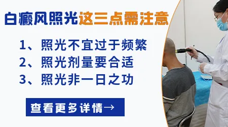 治疗白癜风家用光疗仪能不能替代医院光疗