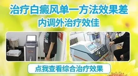 白癜风有没有不用吃药的治疗方式