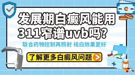 311窄谱UVB治疗全身泛发型白癜风效果怎么样