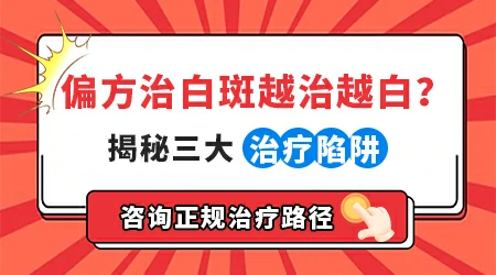 民间治疗白癜风有什么好的土方法