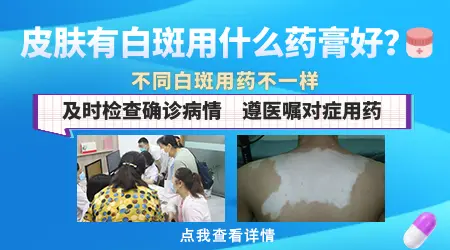 刚出现的白斑用外用药能完全消掉吗