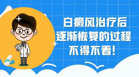 初期白癜风怎么治疗能断根不会复发