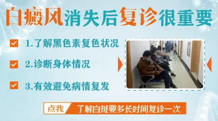 初期白癜风怎么治疗能断根不会复发