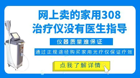 白癜风能不能自己在网上买家用光疗仪在家照