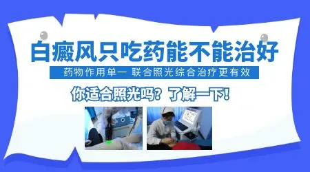 白癜风不照激光只用药能治好吗