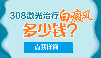 美国308激光照白癜风贵吗