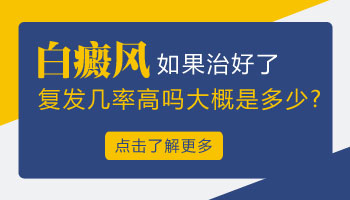 白癜风复发率大概是多少 如何阻止复发