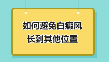 白癜风长在哪里最难治