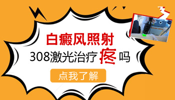 白癜风308准分子治疗过程中有疼痛感吗