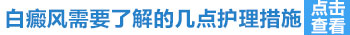 白癜风照光7个月还没完全好能停止照光吗