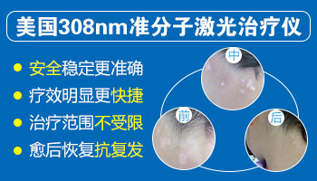 308准分子激光治疗白癜风好转的反应是痒痛吗