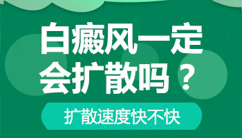 白癜风会不会随着时间面积扩大