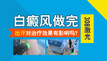 308激光照白癜风部位出汗了会影响照射效果吗