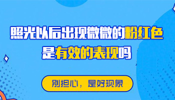 白癜风照了308几次皮肤微红代表什么