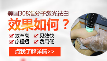 白斑做了308痒得厉害怎么办