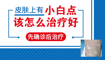 白点的治疗方法 什么原因引起白点