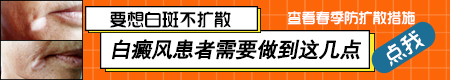 白癜风初期多久时间开始扩散