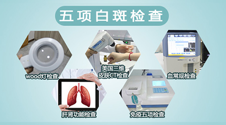 检查白斑是不是白癜风多少钱 