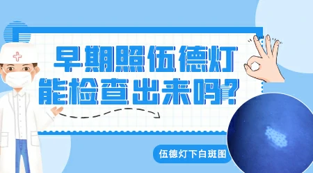 伍德灯照白点呈亮白色一定是白癜风吗