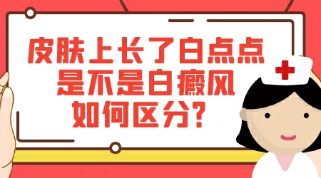 不扩散的白斑会是白癜风吗