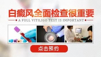 伍德灯可以检查出隐形白斑吗