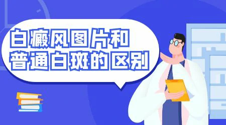 白斑科普|白斑与白癜风的图片区别