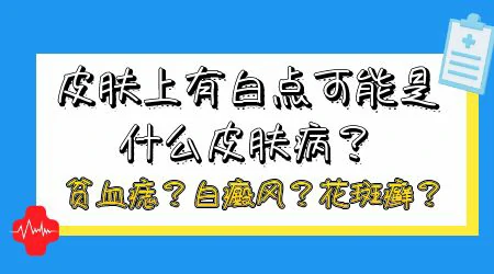 贫血痣图片和白斑的区别