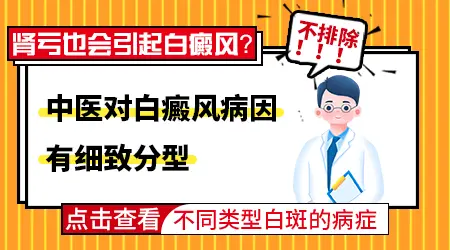 长白斑能治好吗 白斑是什么病