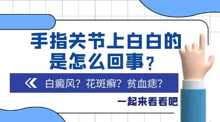 10个手指前端都发白图