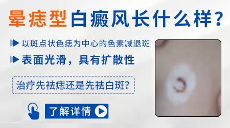 痦子周边发白变大