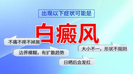 皮肤白斑图片