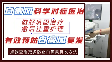 白癜风治好后还会不会复发