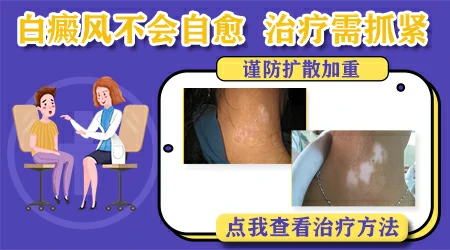 太阳晒出白斑能自愈吗