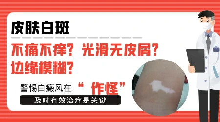边缘不清晰的白斑是什么
