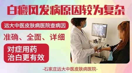 长白斑和平时吃什么有关系吗