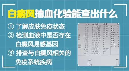白斑查血常规有什么用