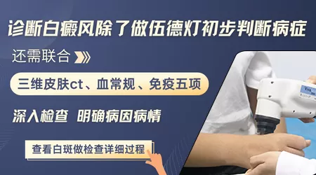 白癜风在伍德灯下呈现什么颜色