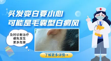 白斑区域的毛发变白意味着什么