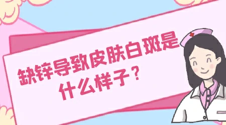 皮肤上有小白斑是缺什么维生素吗
